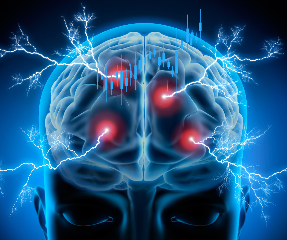 Gehirn mit elektrischer Aktivität und Fokuszentren – Symbol für mentale Stärke, emotionale Kontrolle und Hypnose im Trading